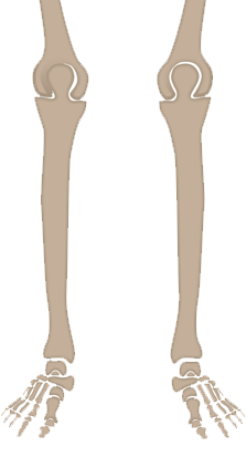 Distal Femur