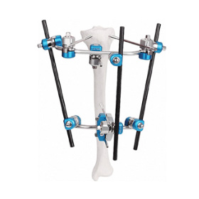 exHEAL HF2 External Fixation System