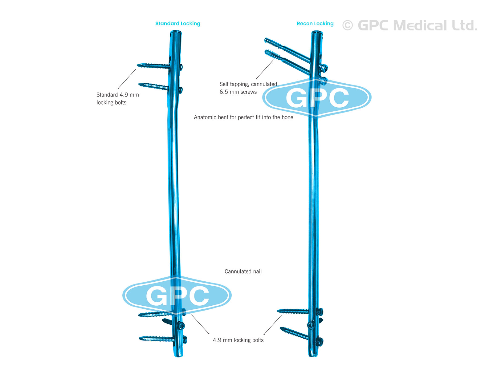 Elastic Nail (Titanium) - orthogrip