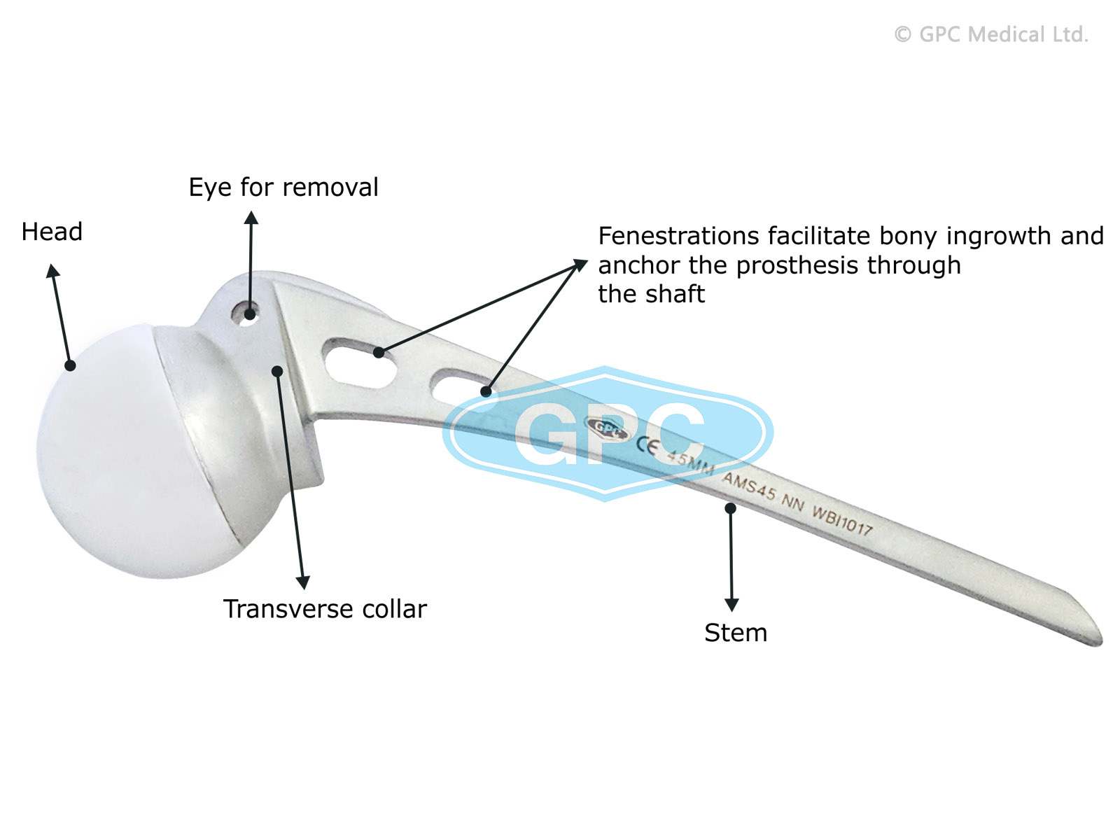 Austin Moore Hip Prosthesis Sterile/Non Sterile